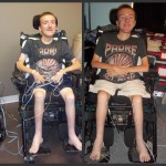 55 Days of One Step At a Time with STS Treatment...